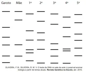 Para verificar a eficácia do teste de DNA na determinação de paternidade, cinco voluntários, dentre eles o pai biológico de um garoto, cederam amostras biológicas para a realização desse teste. A figura mostra o resultado obtido após a identificação dos fragmentos de DNA de cada um deles.
